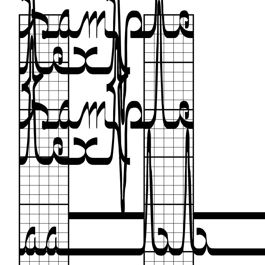 ECG saji